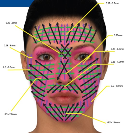 DermapenmicroneedlingNYC