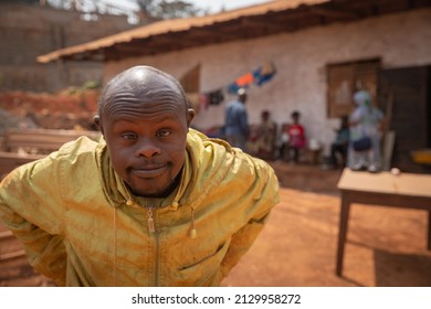 Portrait african man down syndrome 260nw 2129958272
