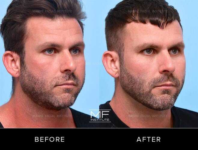 DCM-Before-After-640_1.jpg