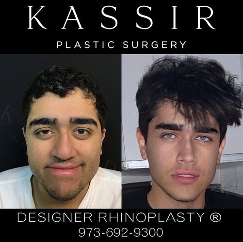 2392467 Unknown procedures