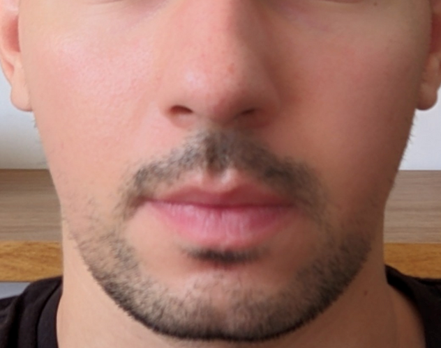 before.png
