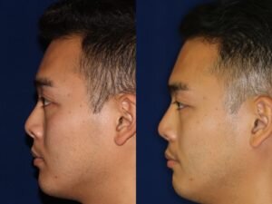 Asian-3-300x225.jpg