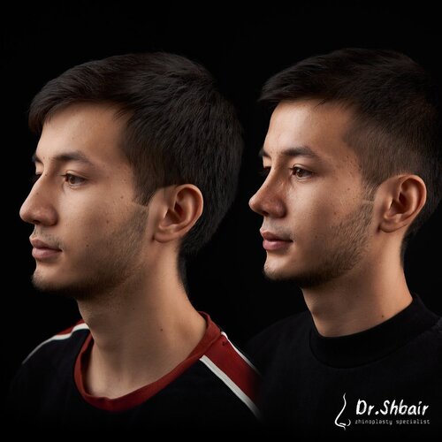 Dr shbair 310524098 2920842621552781 5403755653045720725 n Dr shbair 310524098 2920842621552781 5403755653045720725 n