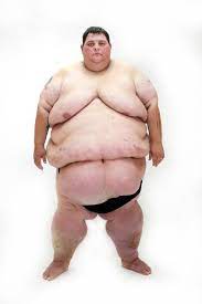 My 600lb Life Transformation Gallery | Inside TLC | TLC.com