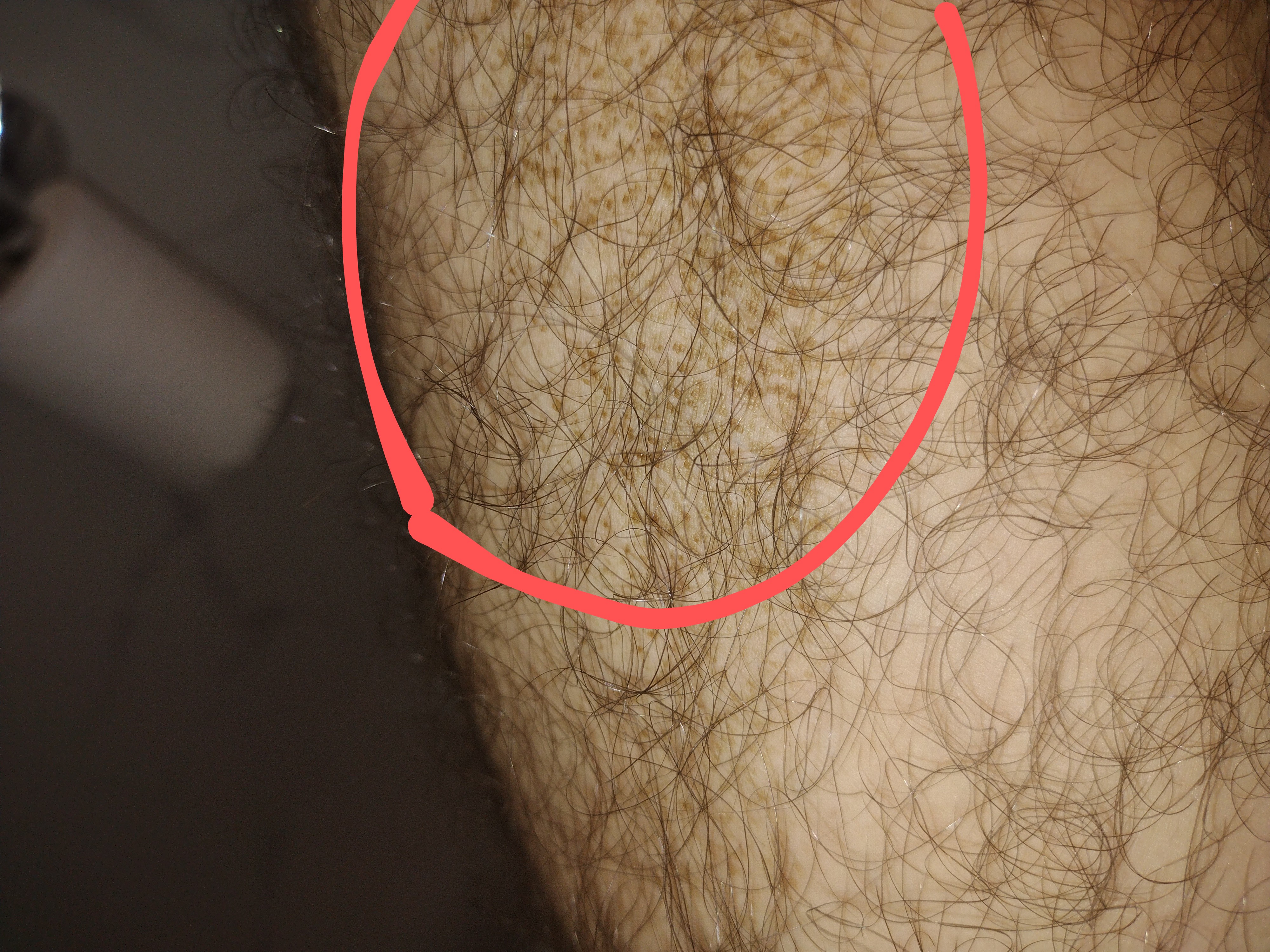 IMG 20230207 1139019702