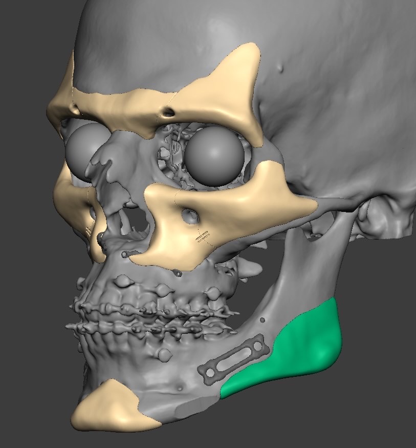 FDF24496 D66C 4C9B AE50 AFF76D691AA3
