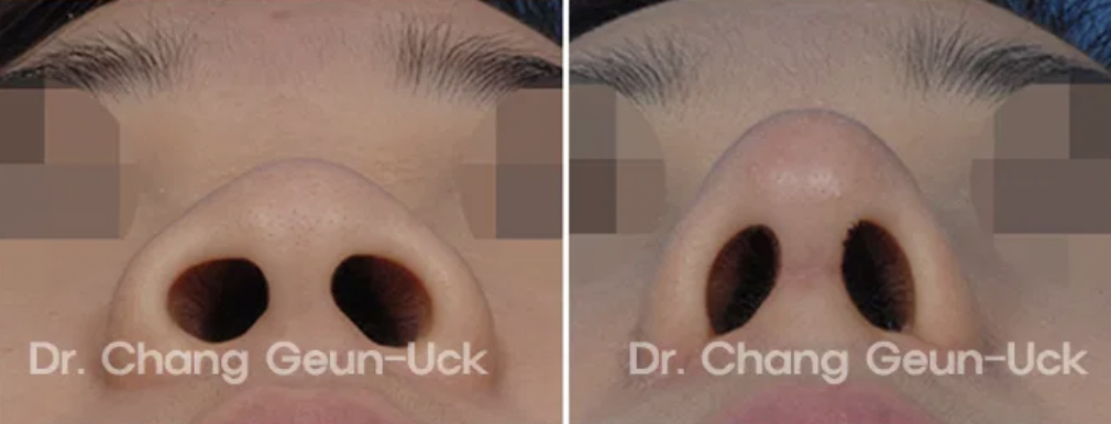 D923024D 5AFB 49EE B62F BCD1F20EAC09