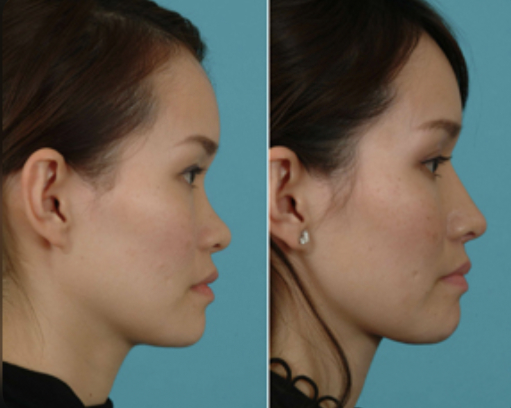 0D2FCAF3 BD39 49BE 96ED 2FC8783F2057