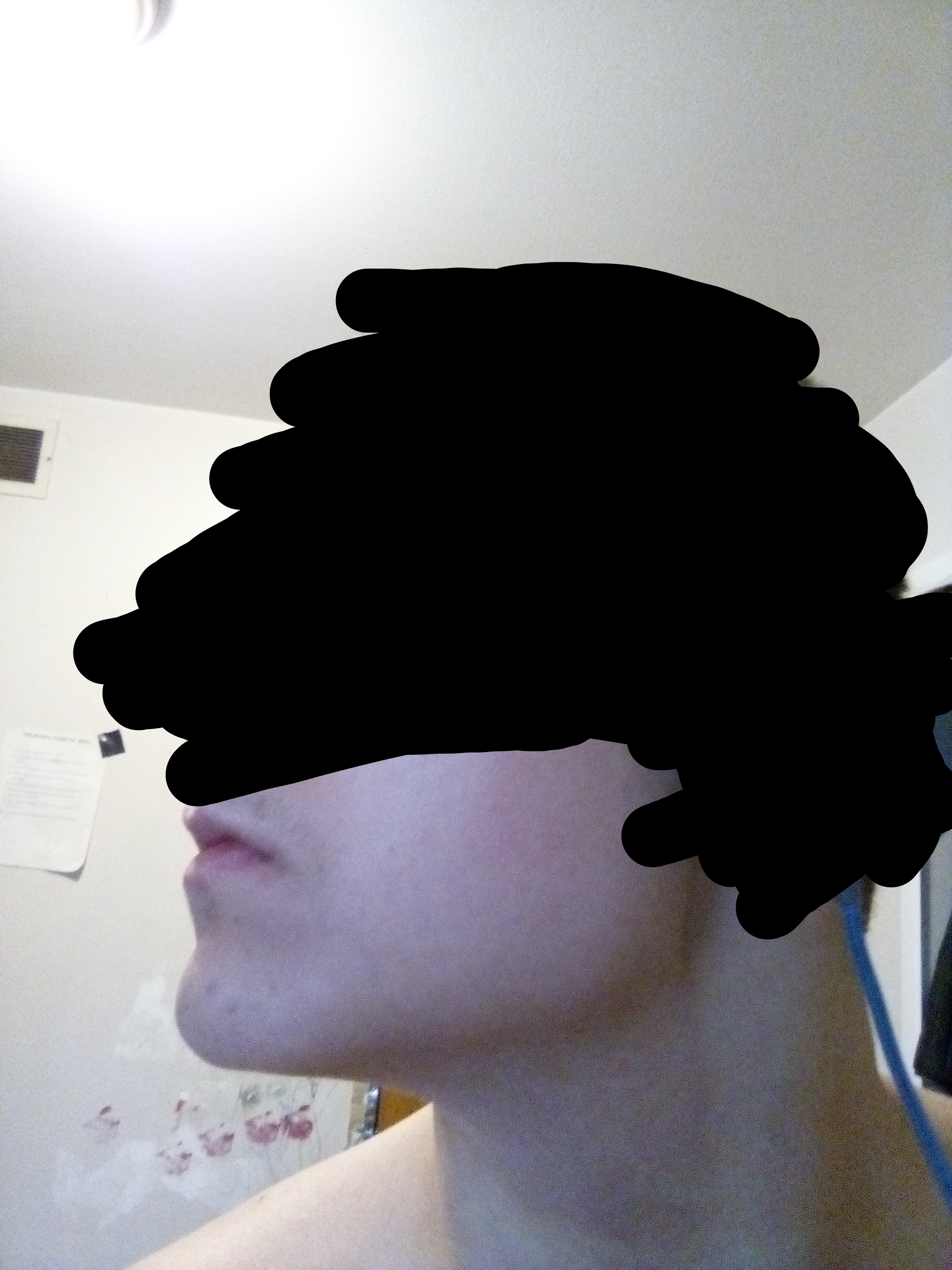 3179920 3179906 side