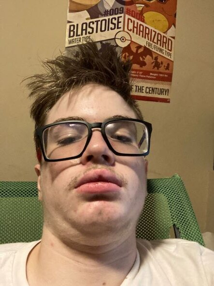 Ugly ass nigga