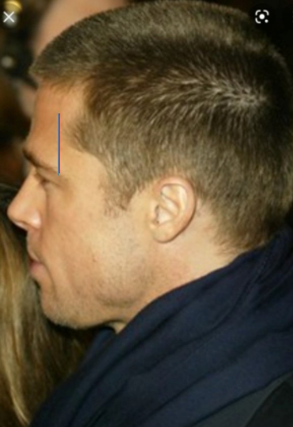 Image 20