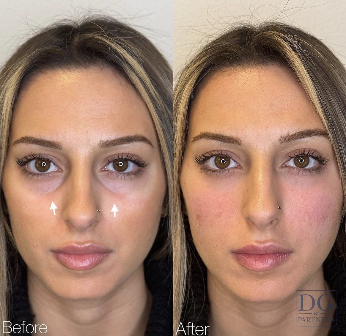 9408B4CD C6CE 4AB1 8841 32851DB49CE6