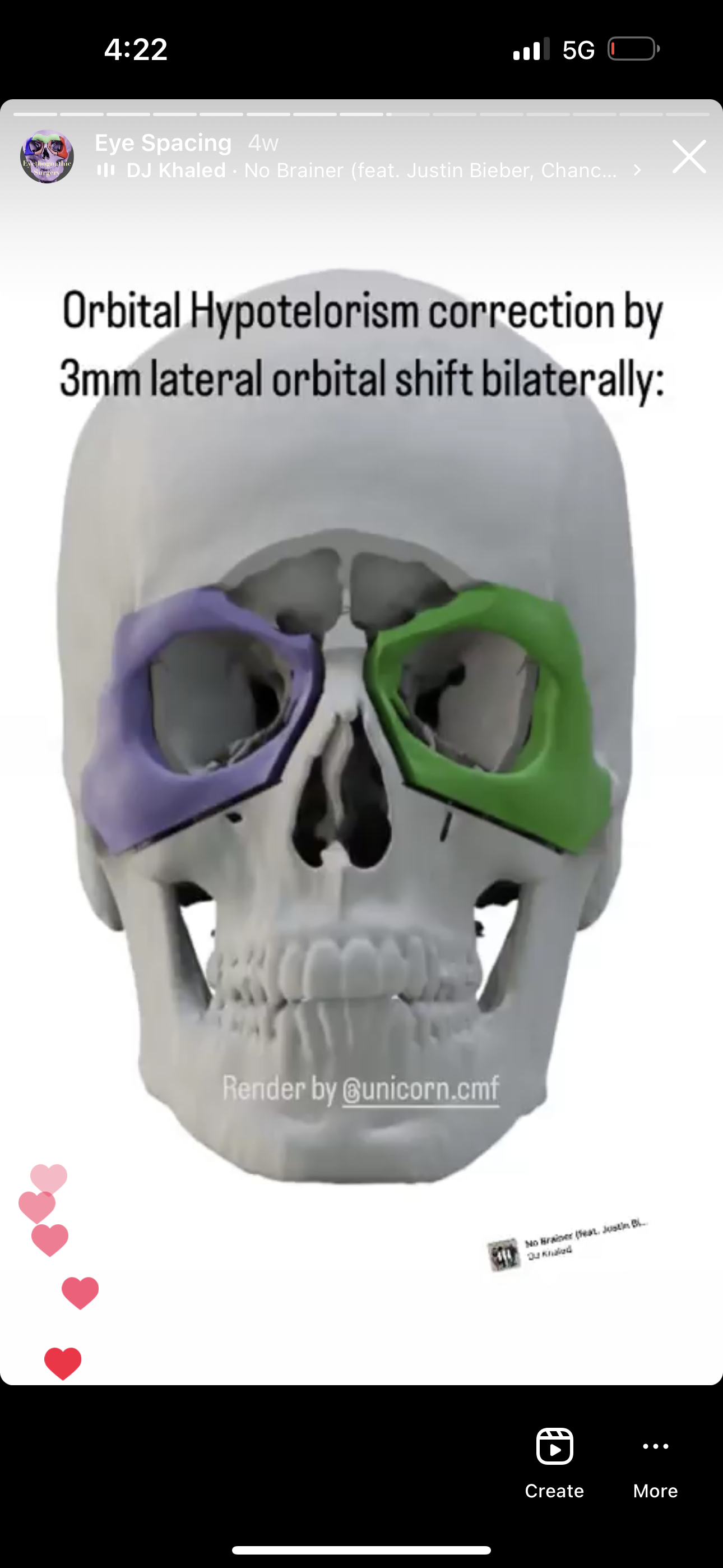 58A1A891 B025 4BAF AD10 DE8212D7A71A