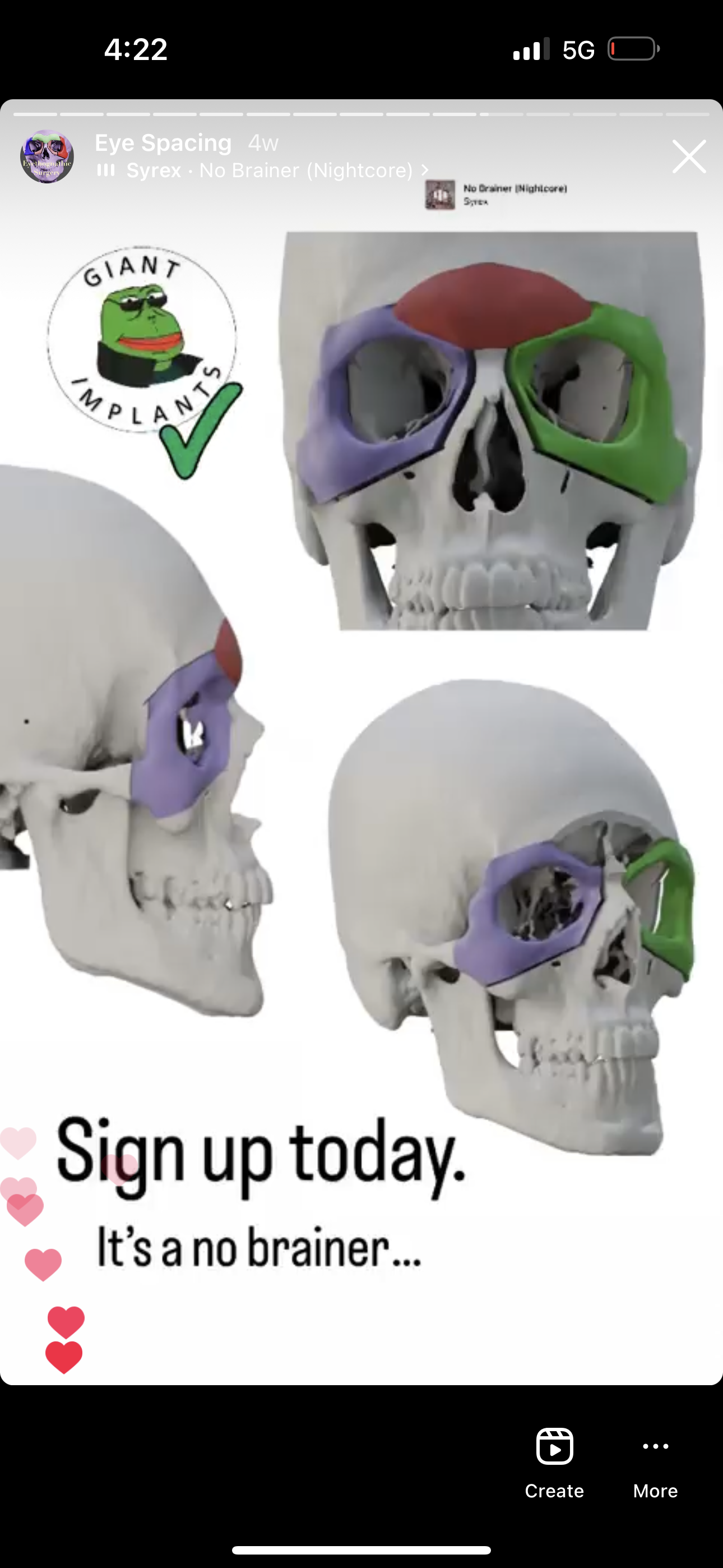 BD6DFC1E CE41 421A 83FC 9D0AAB9E9163