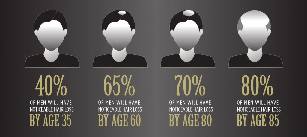 20150323 Hairloss20s MensStats 750x330 1024x458