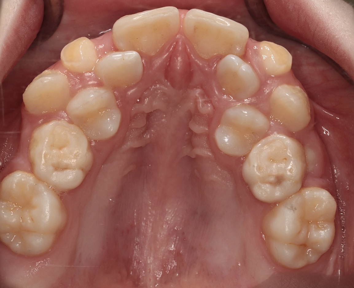 4C561EA2 7953 42CC A2E2 5CB29B3A9BC4