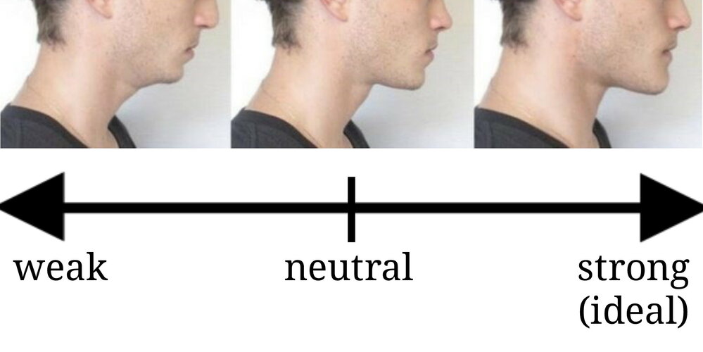 Weak Jaw Vs Strong Jaw Receding Chin Pictures Causes Exercises 