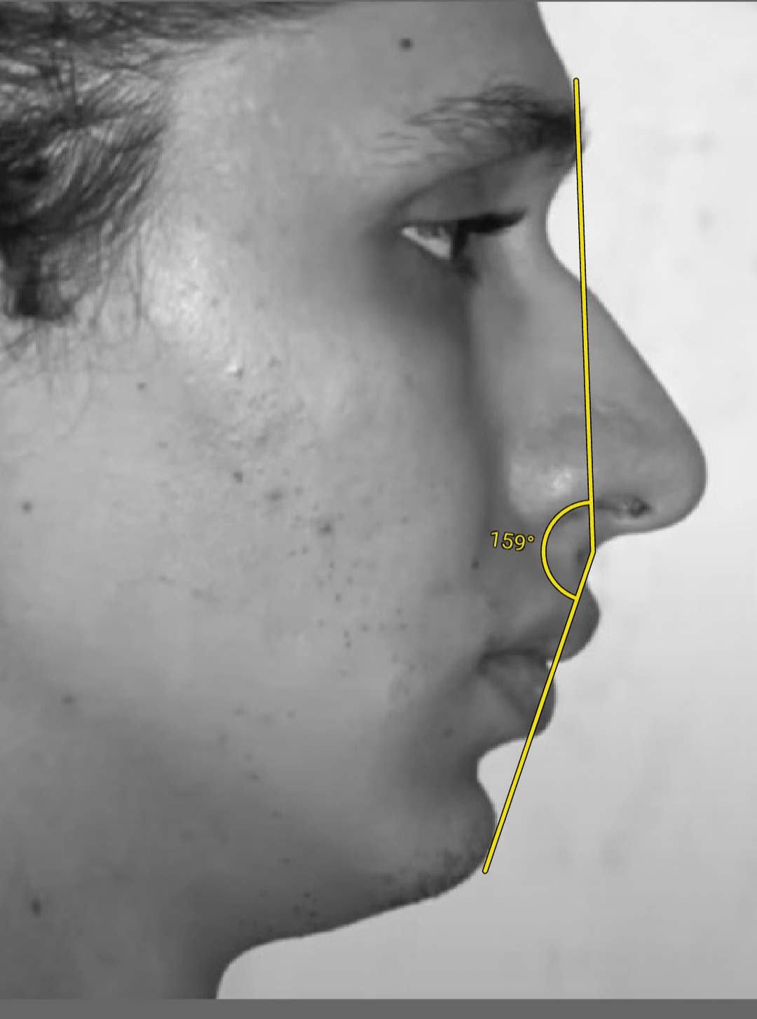 Screenshot 20230301 122855 ImageMeter