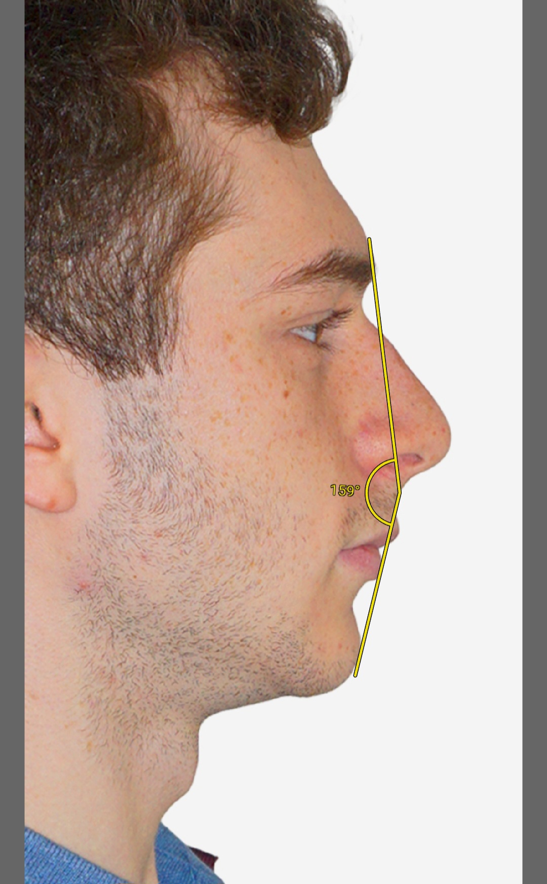 Screenshot 20230302 190414 ImageMeter