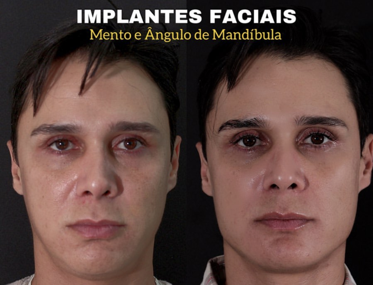 63EF2041 F197 4B57 9EB6 6E71D238D546