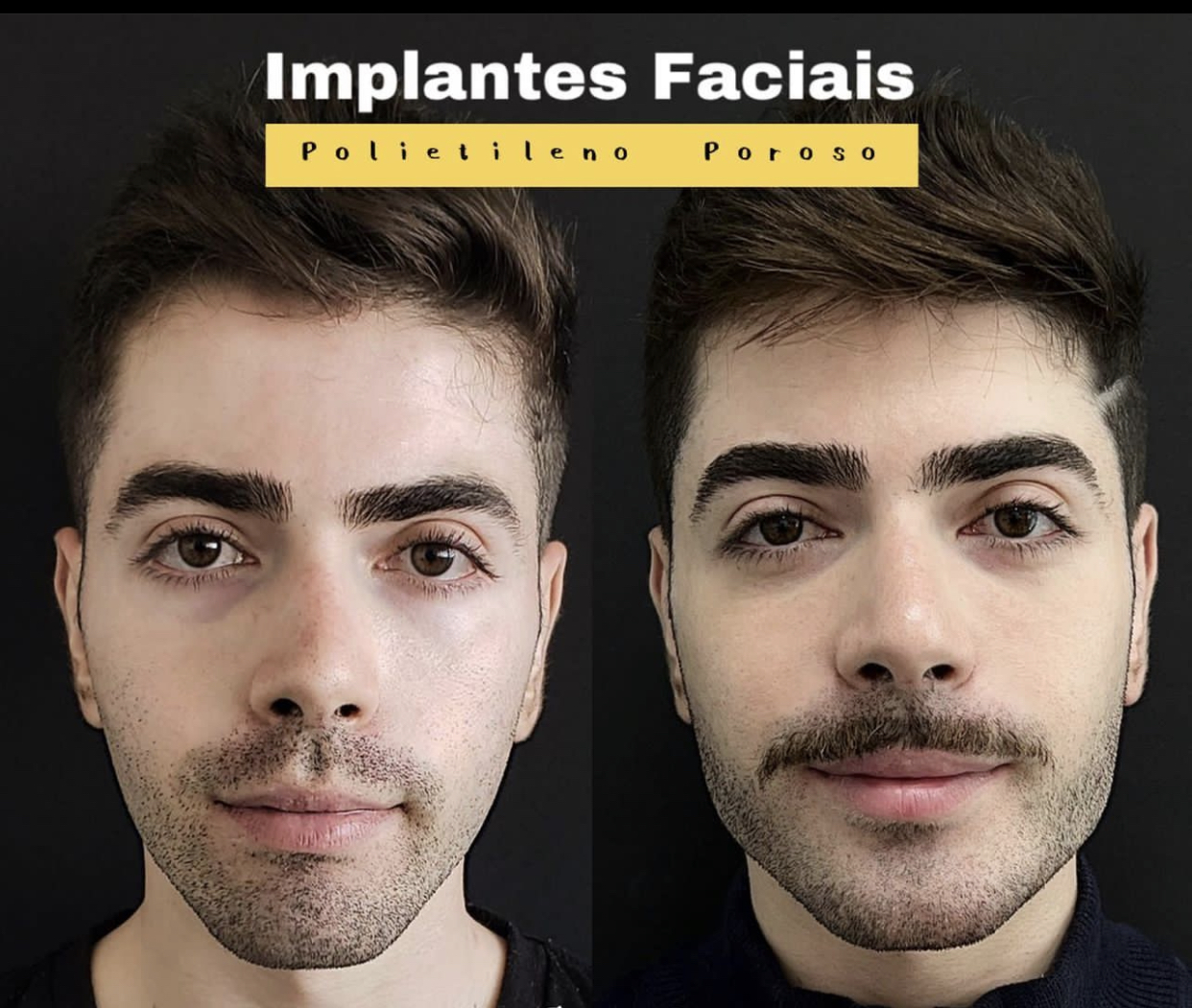 F3AD7DF4 D000 469E 9585 0CB3684286F4