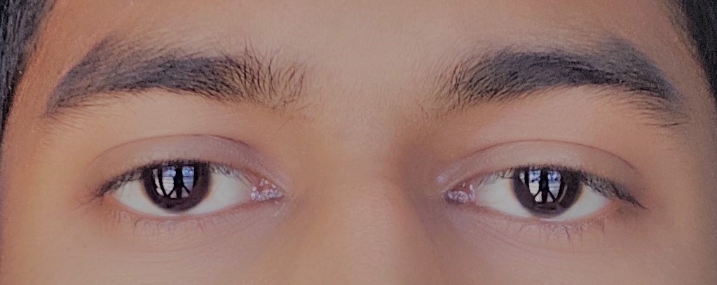 Eyearea