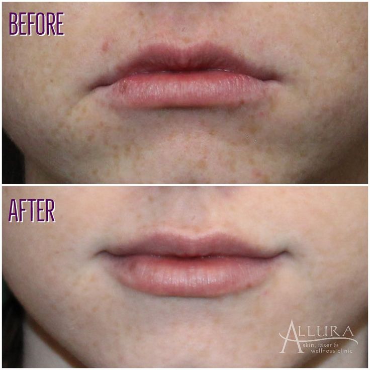 F2FE09B1 253F 4735 B8AC 6CFCDC3C6119