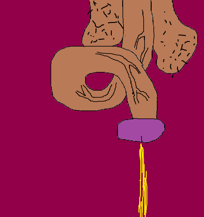 Dick