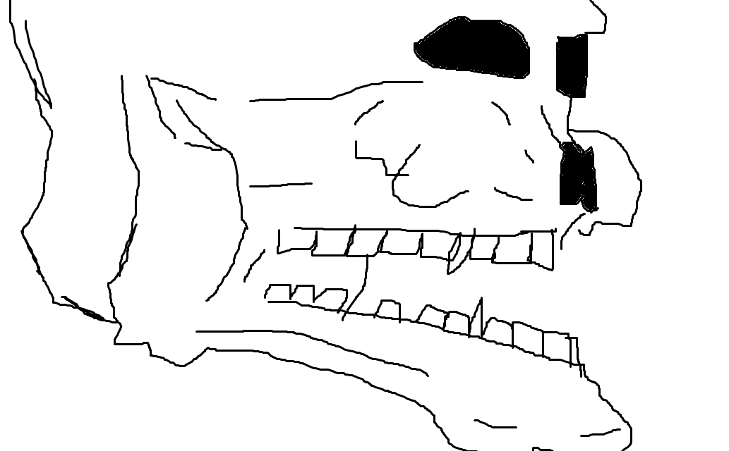 Skull1
