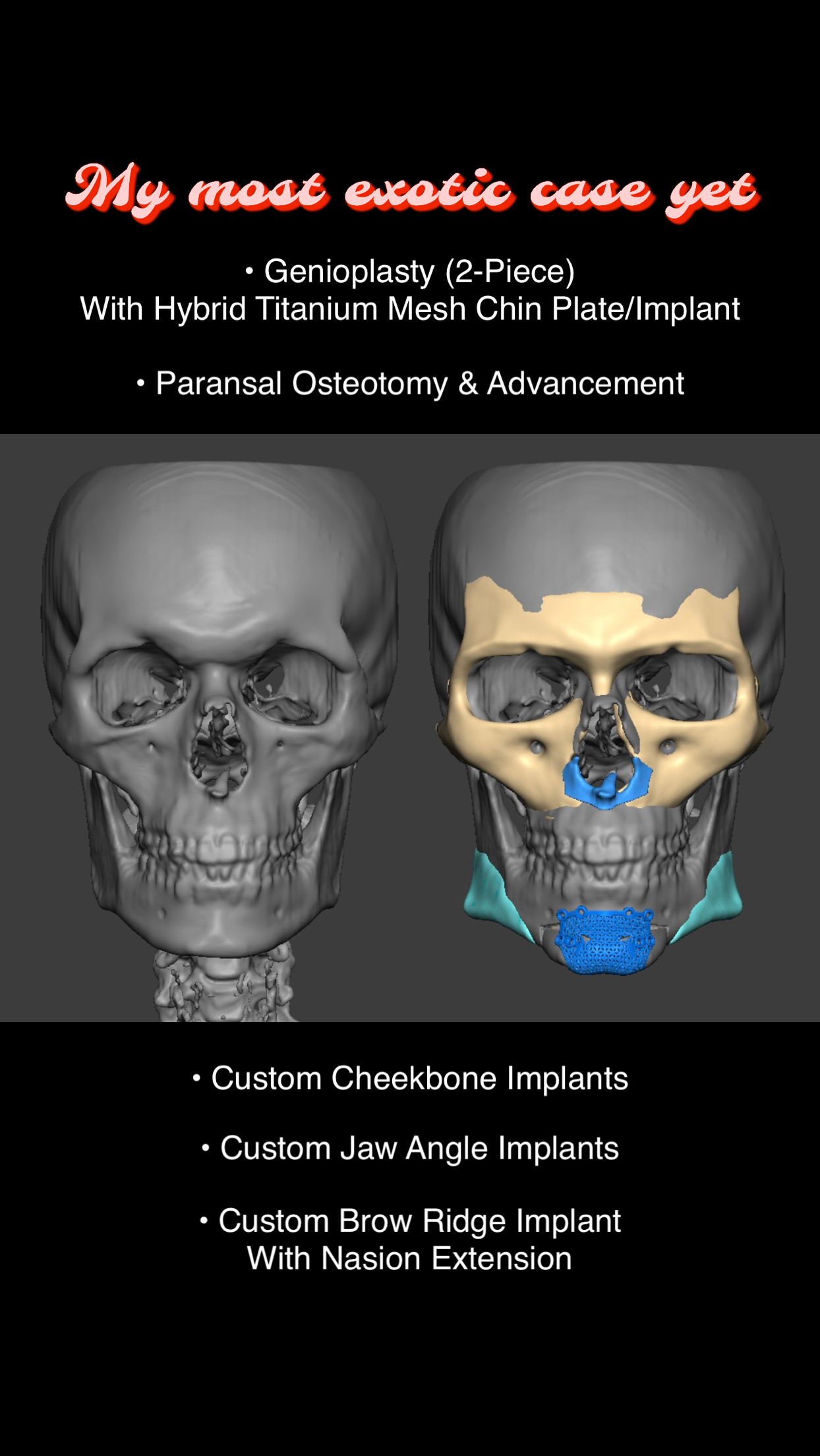 C5B01A5C 17F9 48E3 9141 E32DC49CE532