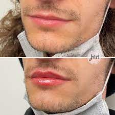 4CB39209 623E 4BE6 9ABE ABE7BA4BD2BE