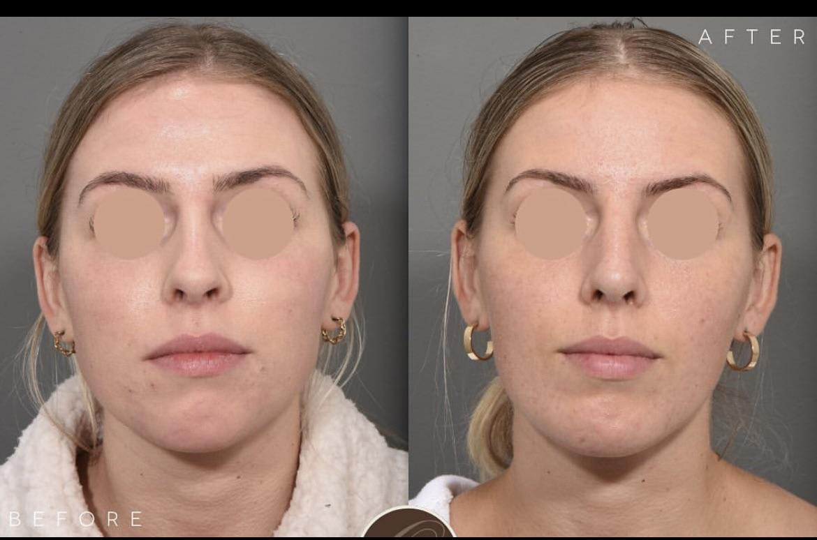 RDT 20230329 1831065742233786212593467