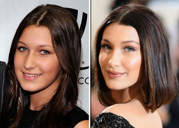 Bella Hadid before and after 1050930