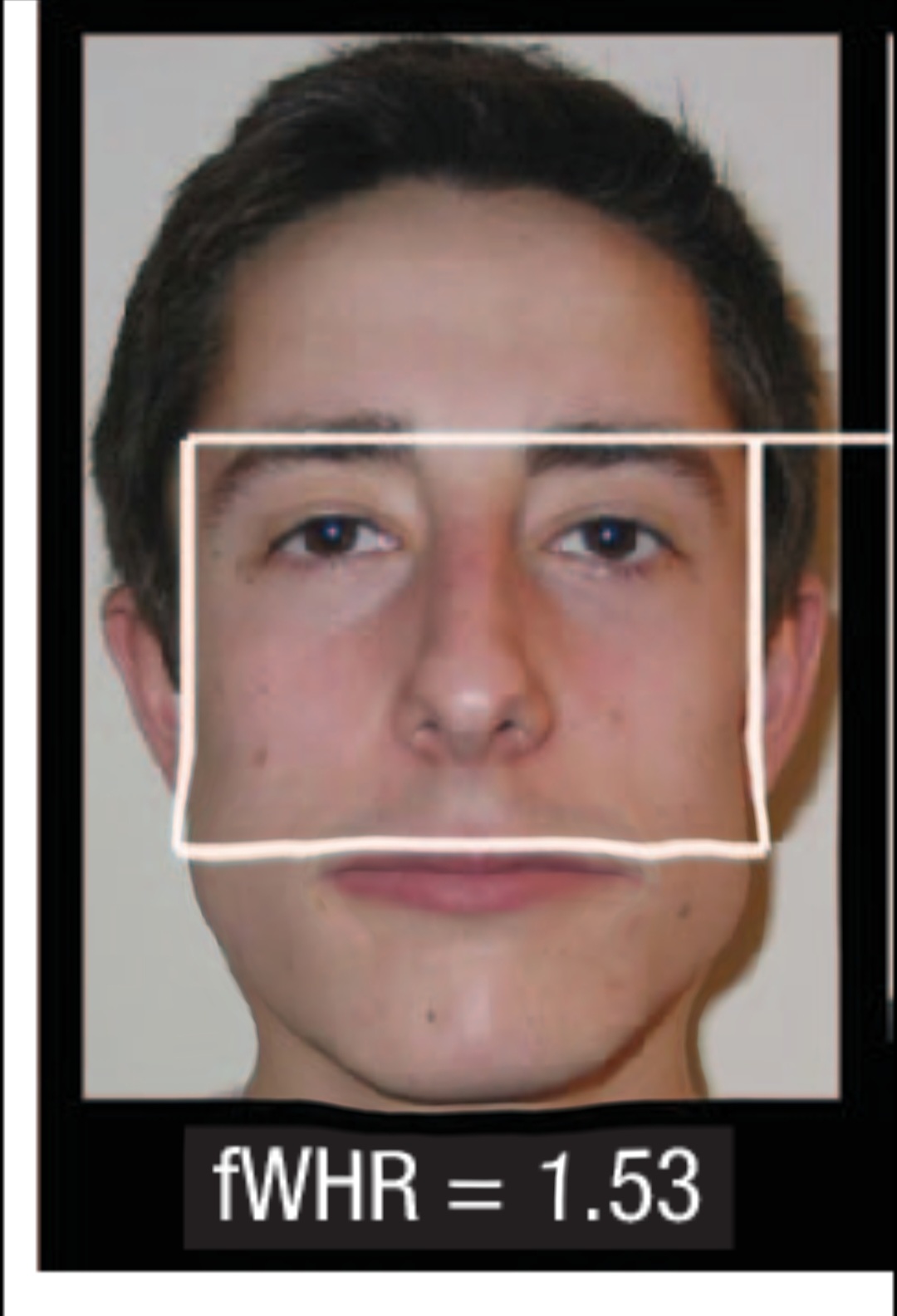 Screenshot 20230401 162522 Plastic Surgery Simulator