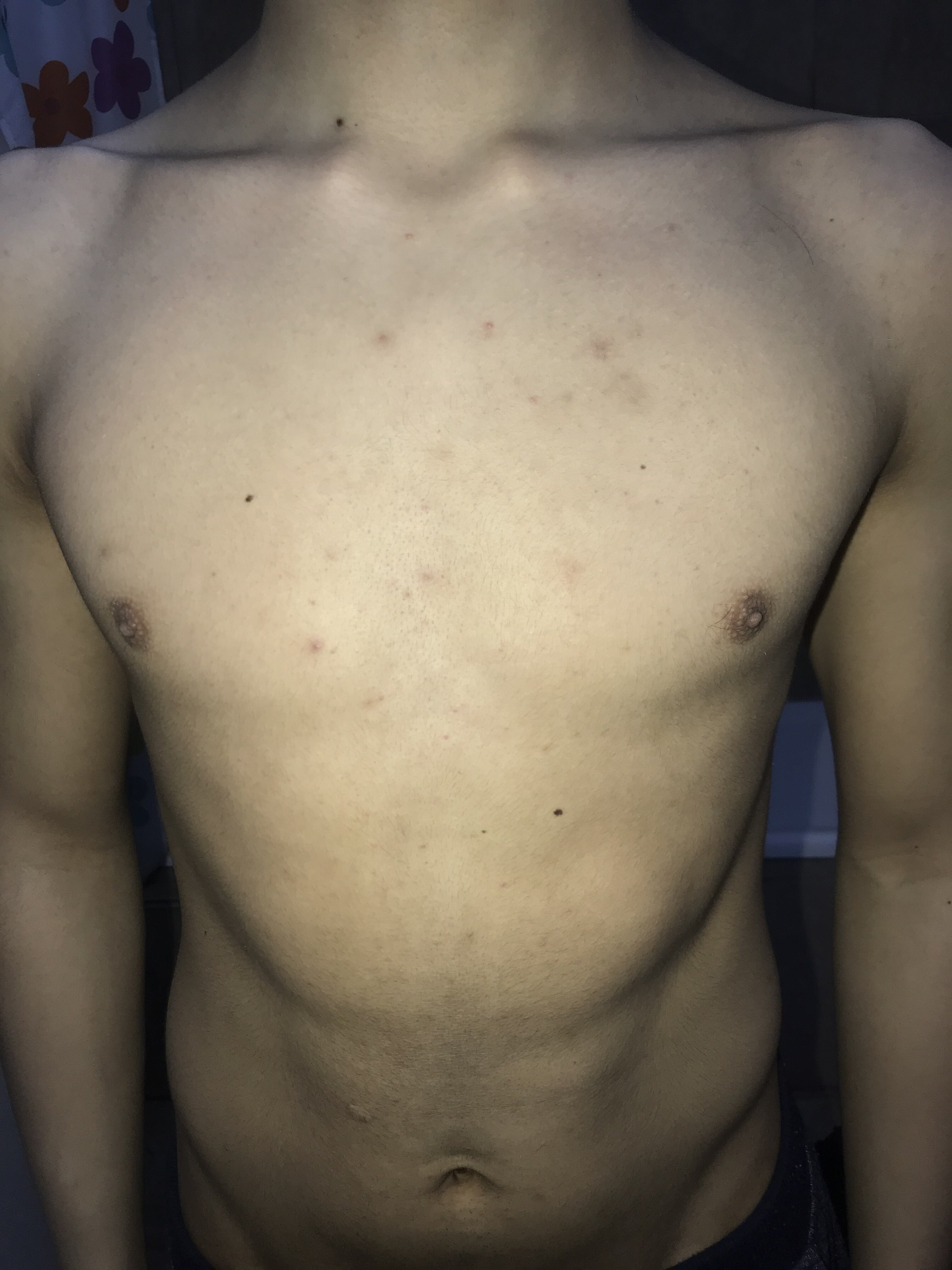 62128965 CD97 434B 9BC6 52747E4B74B1