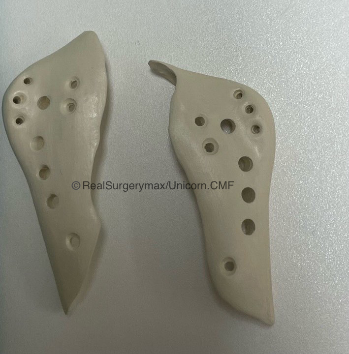 0B1F298C 31F1 4BD3 A64C FEF80A6AFA2D