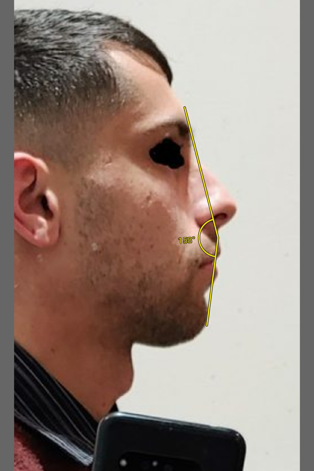 Screenshot 20230405 035110 ImageMeter