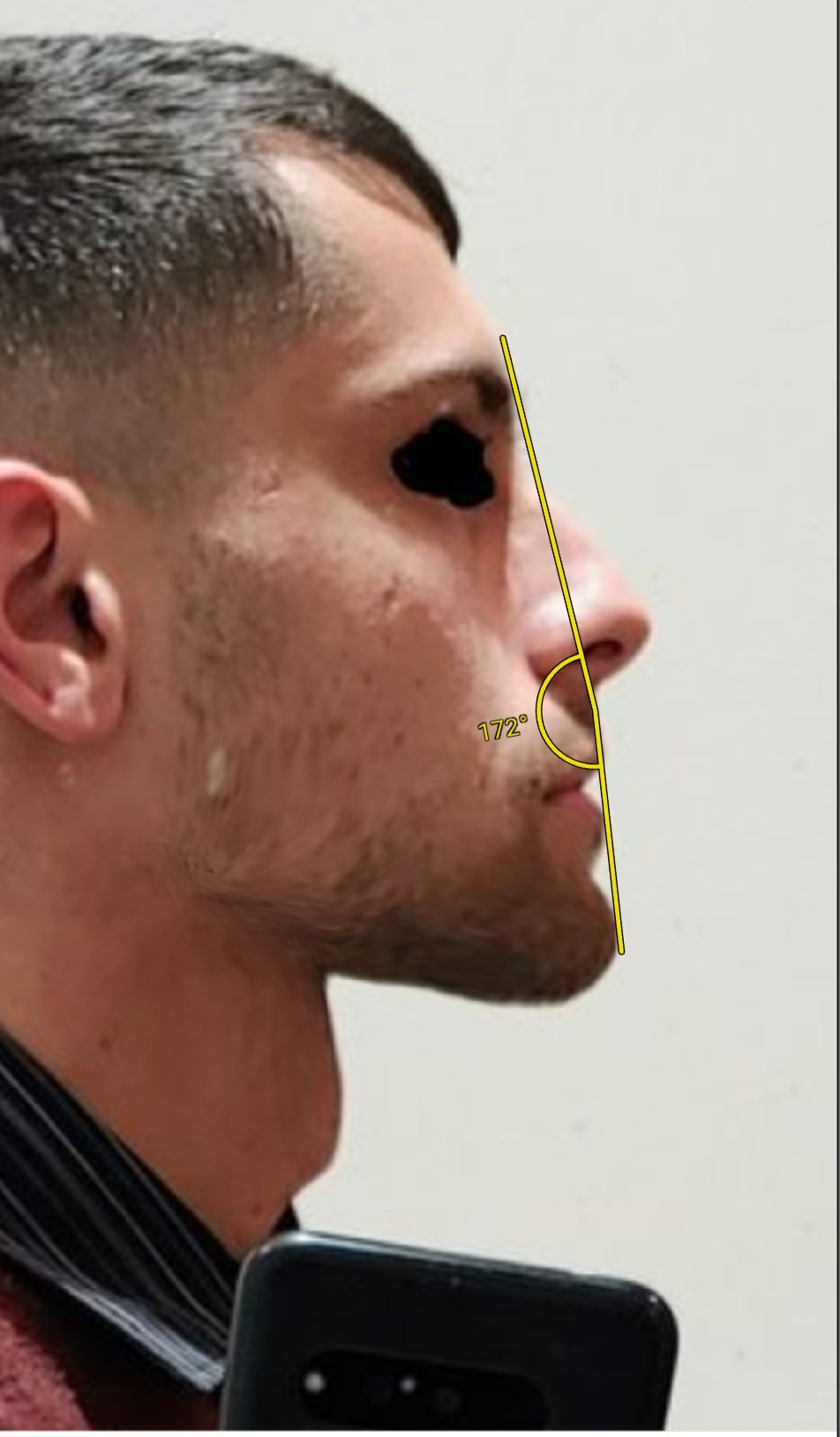 Screenshot 20230405 035401 ImageMeter