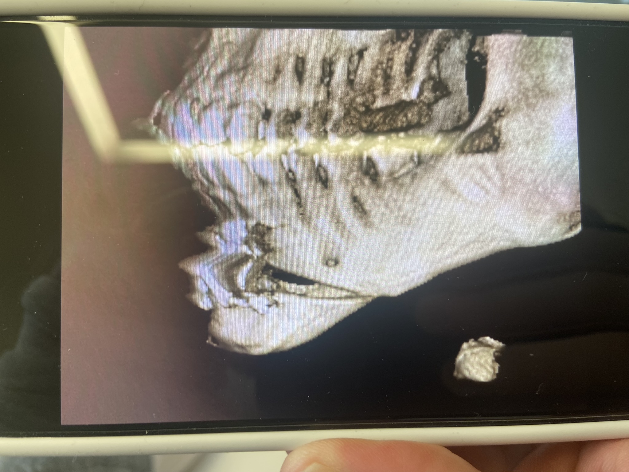 3350607 B034E3C1 D6A0 4515 A020 62AC1BBFB535