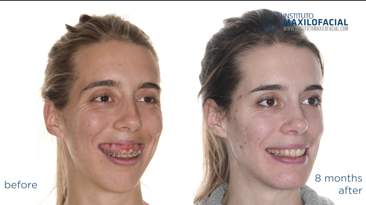 Maxresdefaultalfaro