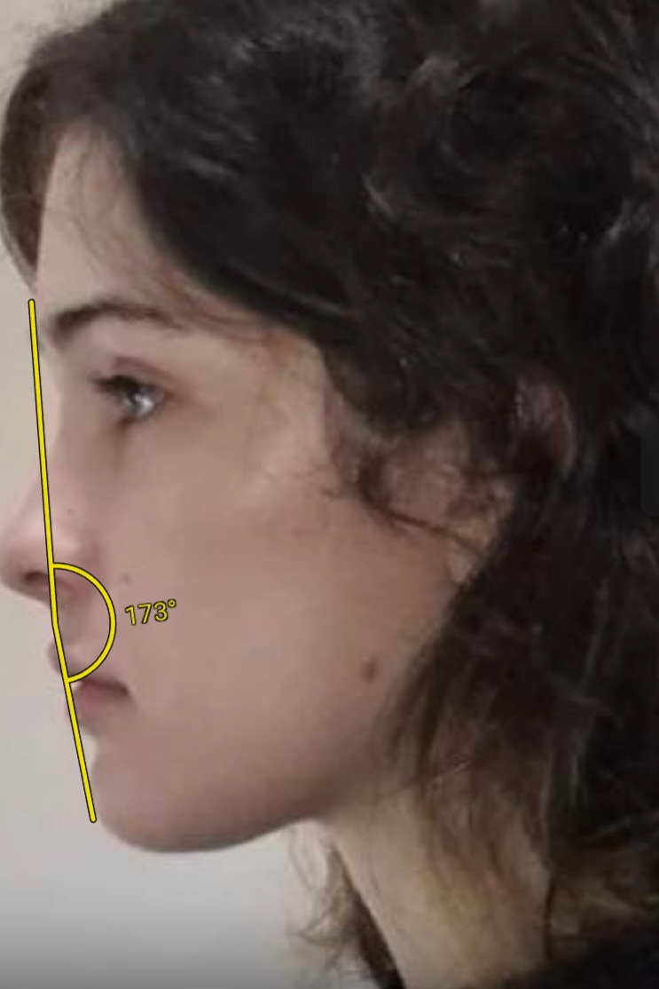 Screenshot 20230410 232840 ImageMeter