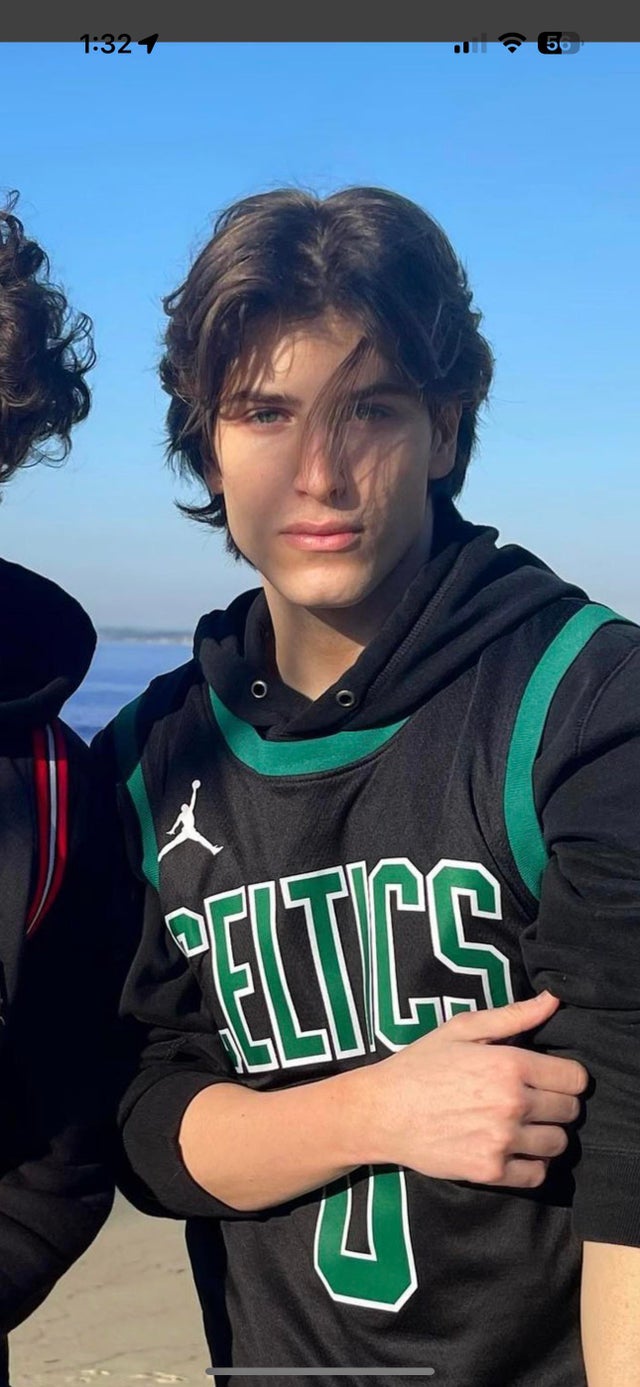 What do we rate syrianpsycho before and after looksmaxxing v0 pn1hg9vw92ca1