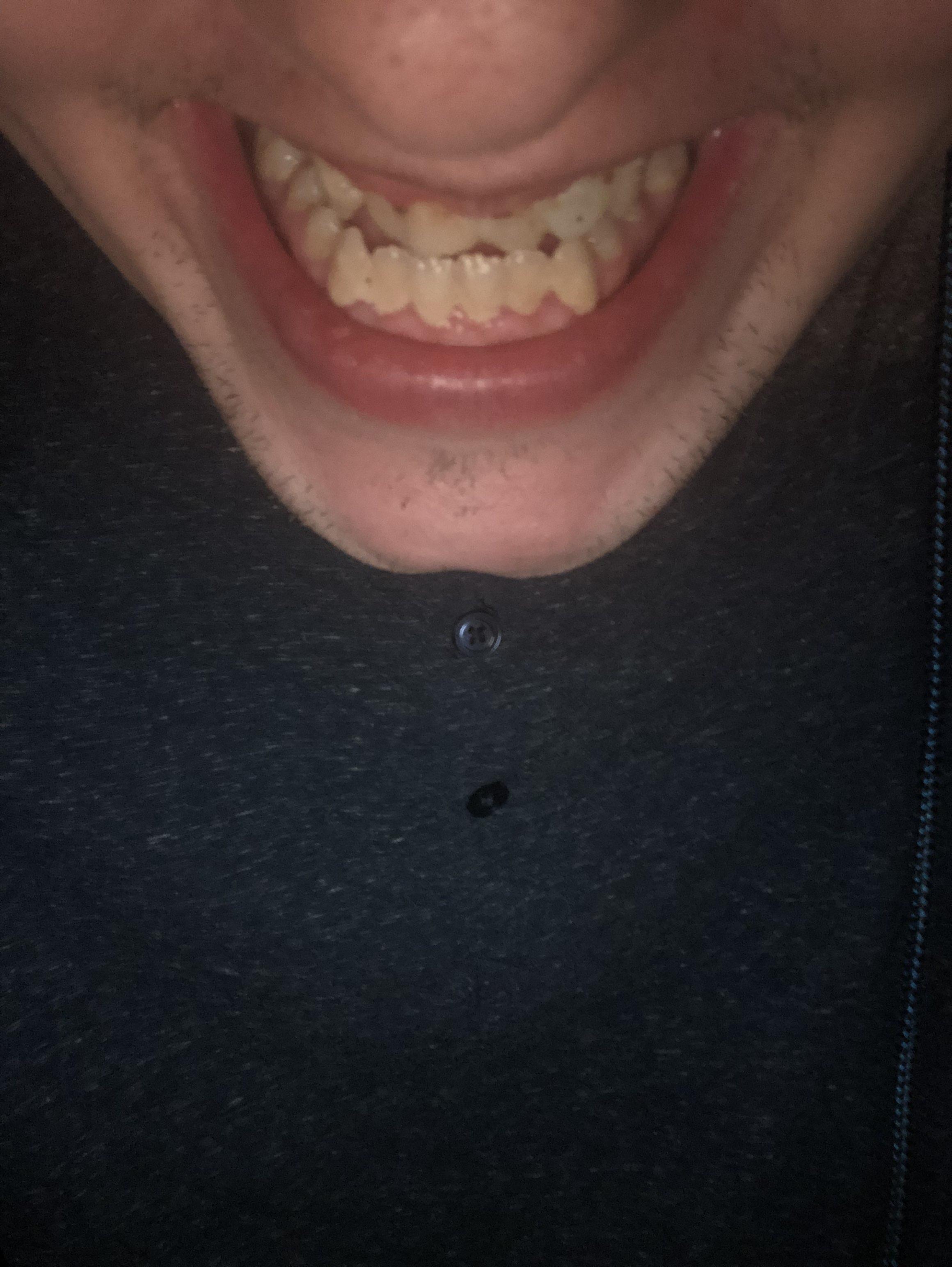 IMG 1989