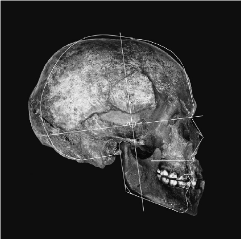 Illustration of the size and shape differences between a fossil photograph of skull P4