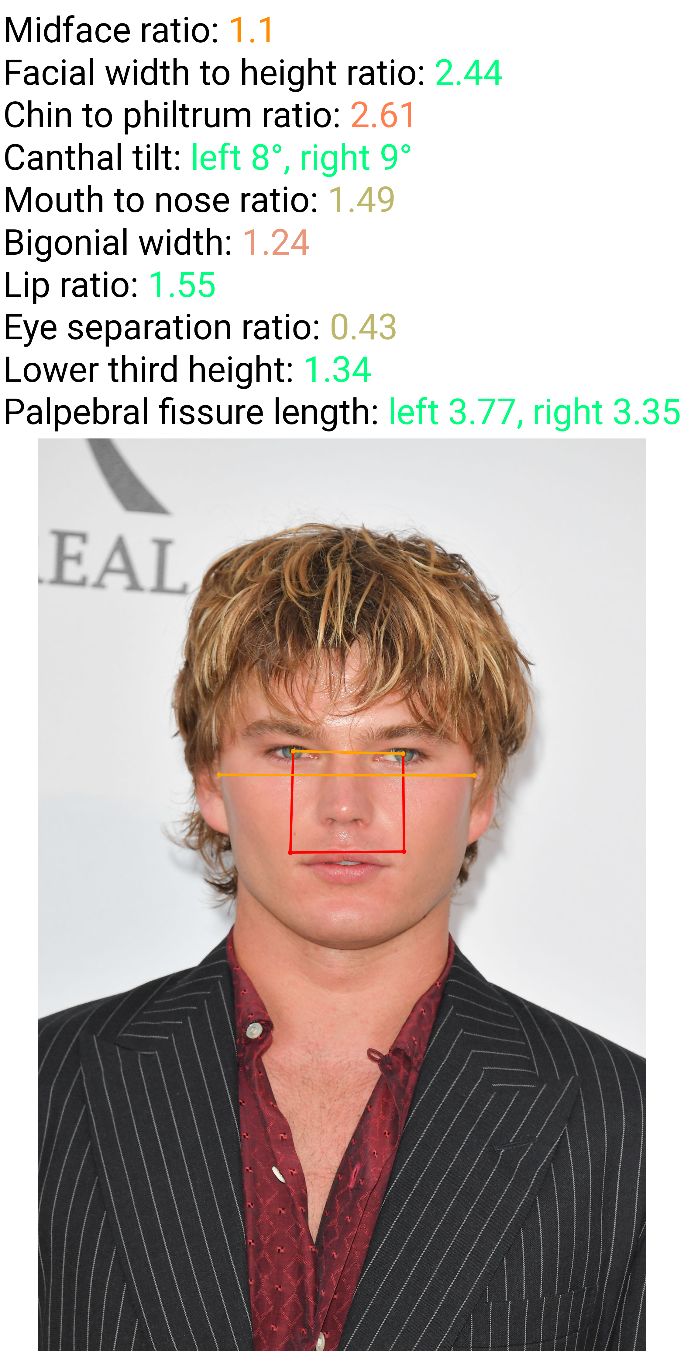 GettyImages 1151276685 looksrated