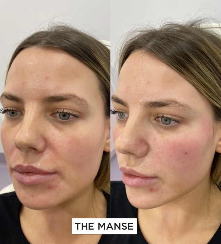Sami before and after 726x800