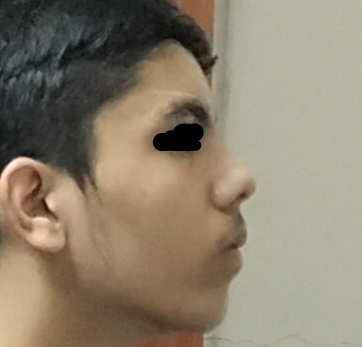 3363656 IMG 20230417 182135