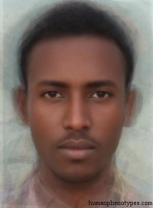 Ethio