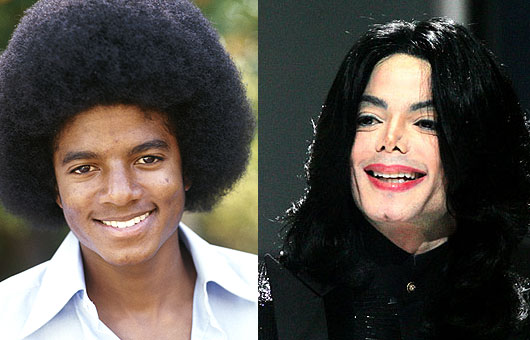 Michael jackson facelift before after