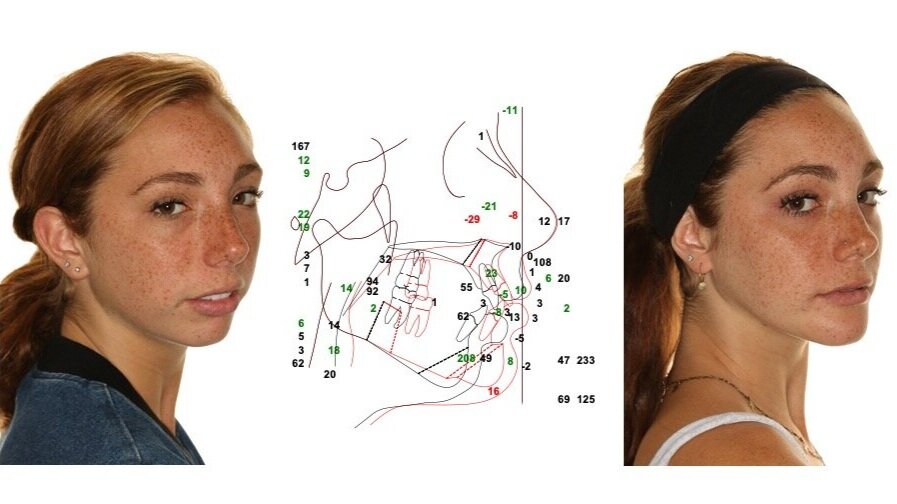 3099336 AgReplacementimage2